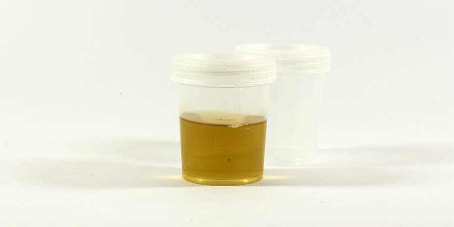 Why Fetish Urine Is More Common Than You Think